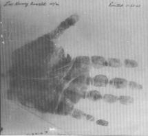 Oswald Right Palm Print