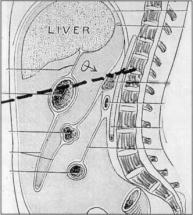 McKinley Assassination - Path of the Bullet