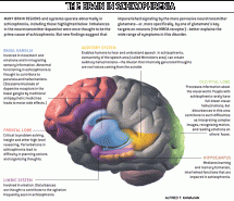 Schizophrenia - Studying the Brain