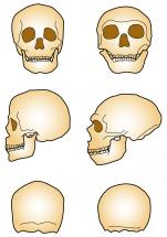 Comparison Drawings